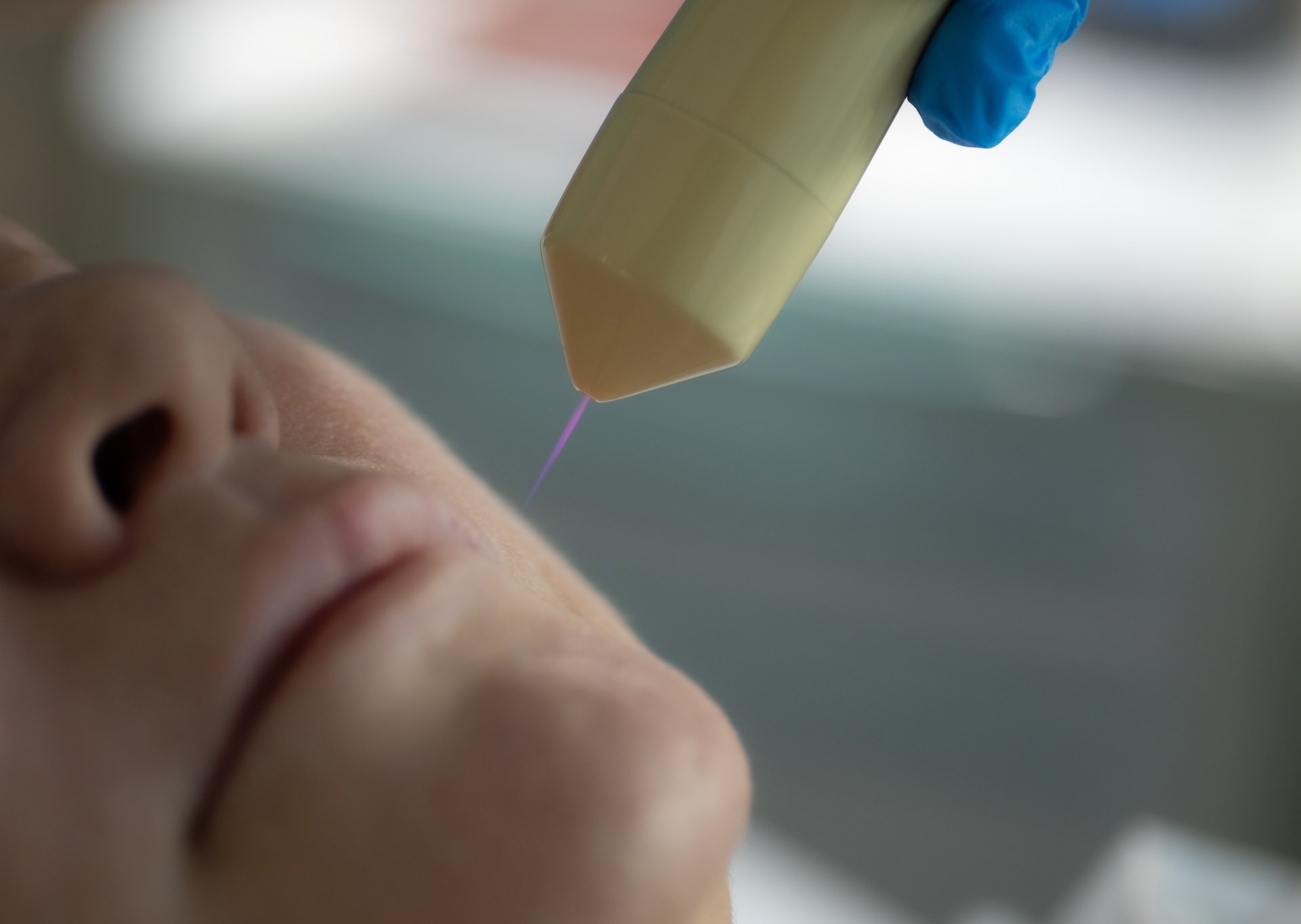 ХИЛТ-терапия (высокоинтенсивная лазерная терапия)