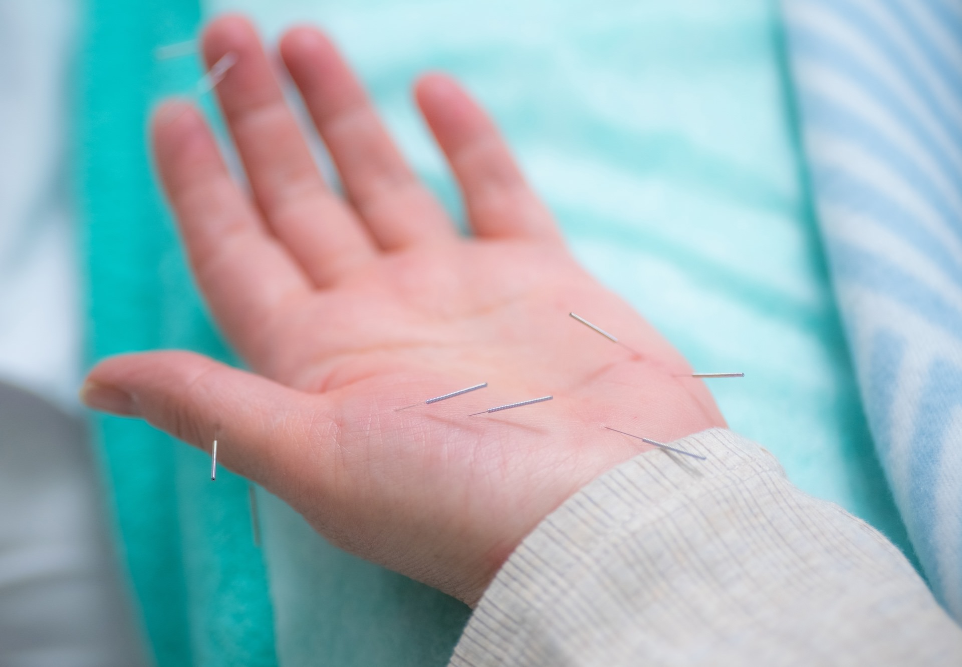 Рефлексотерапия и иглоукалывание