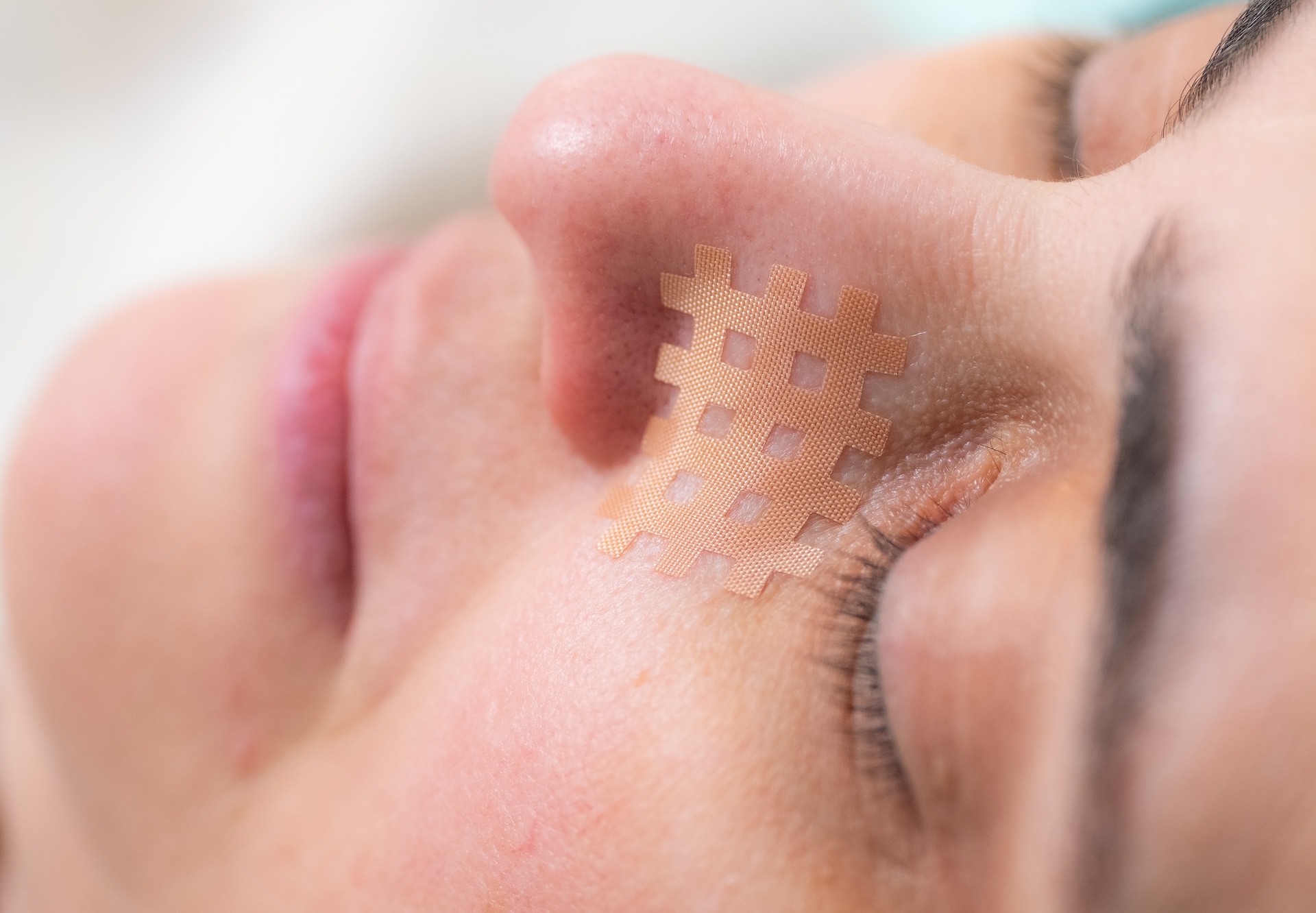 Акупунктурное кросс-тейпирование