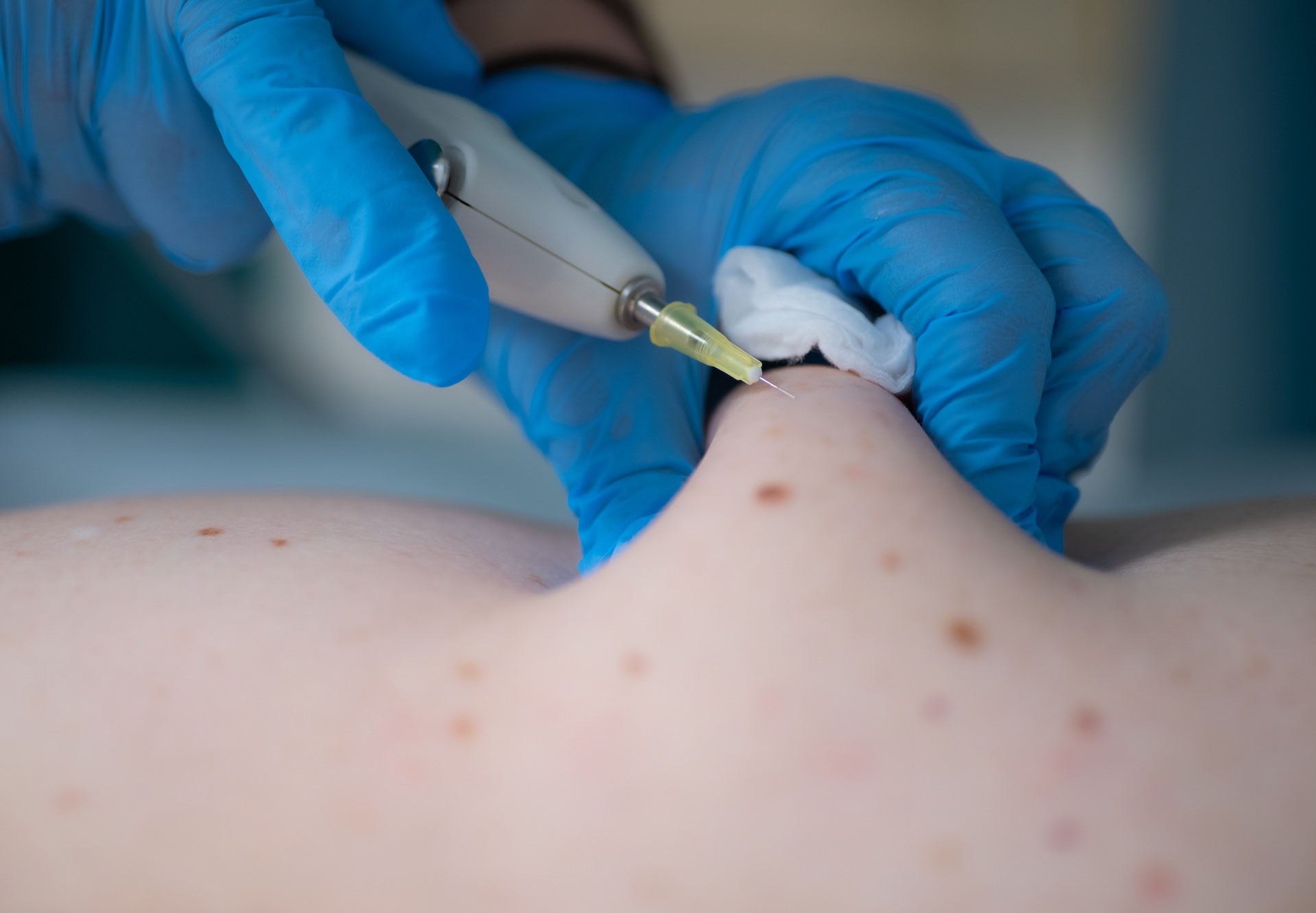 Инъекционная терапия